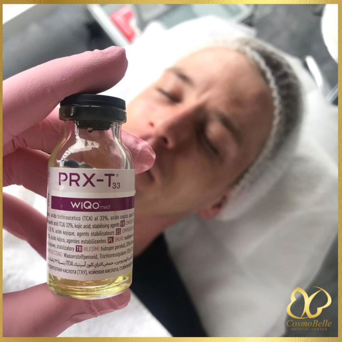 PRX-T33 to najnowsze zastosowanie połączenia kwasu TCA z kwasem koliowym stosowany w medycynie estetycznej, redukuje blizny, poprawia owal twarzy i rozjaśnia skórę.