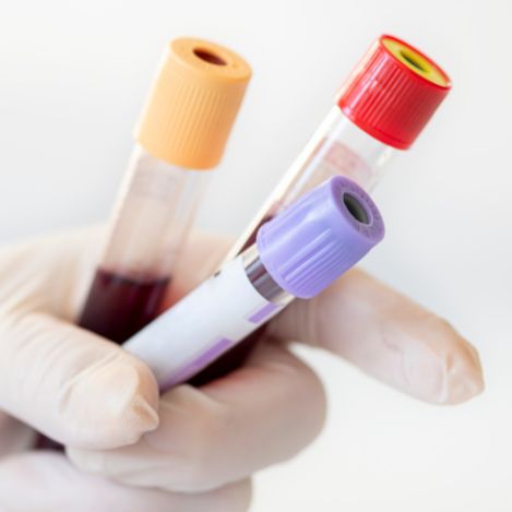 Pakiety badań krwi